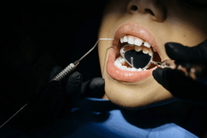 dentist visit